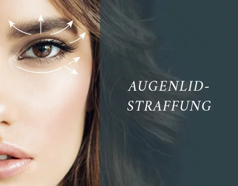 Augenlidstraffung, allaboutyoureyes 