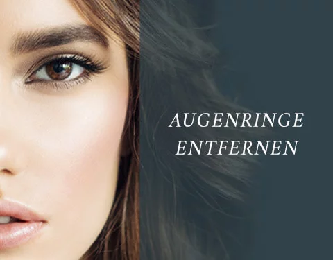 Augenringe entfernen, allaboutyoureyes 