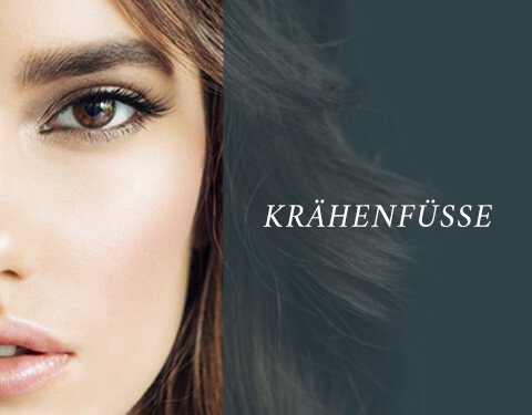 Krähenfüsse, allaboutyoureyes 